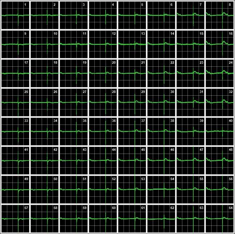 図:各電極の波形(再現性:良好)
