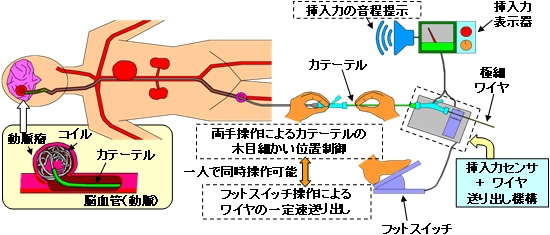 脳血管カテーテル治療用支援機器の開発研究で学会表彰｜広報ニュース
